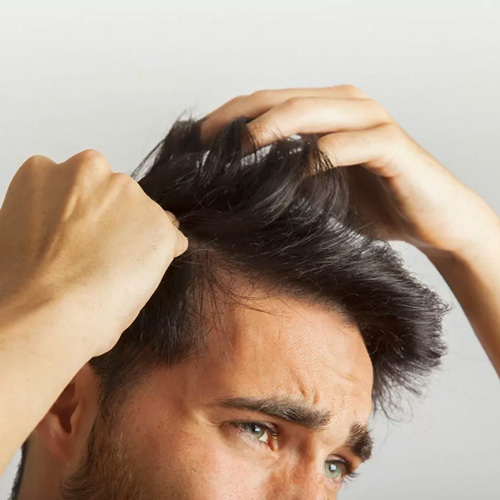 بهترین محصول ضد ریزش برای درمان ریزش مو چیست؟